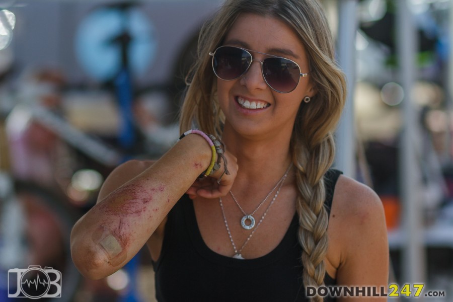 Shelly Flood bearing yesterday's damage, and a smile - nothing brings Shelly down, it's time to ride!